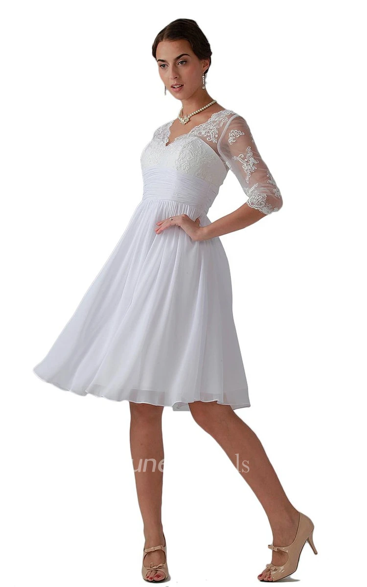 Knee-length Scalloped A-line Dress With Lace Appliques